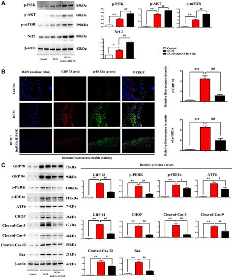 Lncrna H19 Inhibits Er Stress Induced Apoptosis And Improves Diabetic