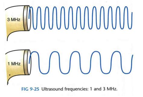 Ultrasound Flashcards Quizlet