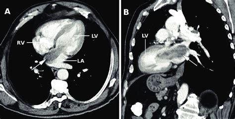 The Ct Scan With Intravenous Contrast Medium Administration Showed A Download Scientific