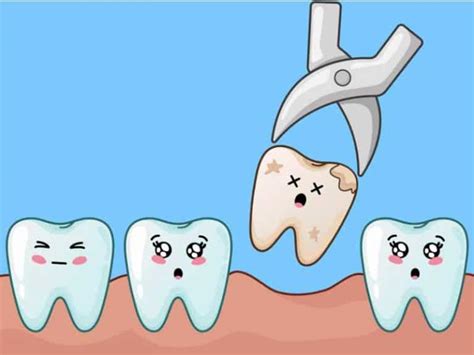 Tooth Extraction Stages Of Healing Teethstars