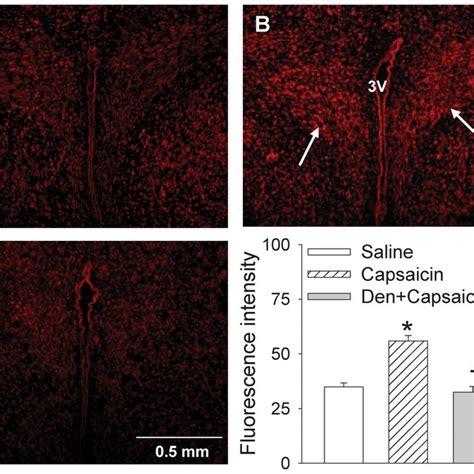 Effects Of Microinjection Of NMDA AMPA AP5 CNQX Or AP5 CNQX Into