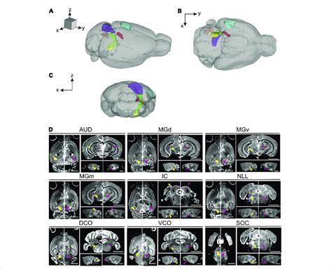 Magnetic resonance imaging of the auditory pathway. (A-C) 3D volume ...