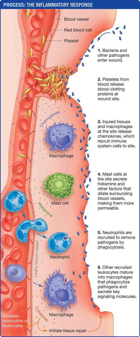 Inflammatory Response Naturalremediesheartburn Medical Laboratory Science Medical Laboratory