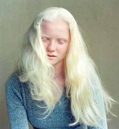 Why is it so hard to get white (albino) hair? - Daz 3D Forums