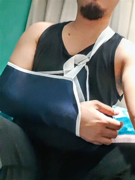 J.M.Acop - • FRACTURE HEALING TIME 🦴🕐 Most healthy people who suffered