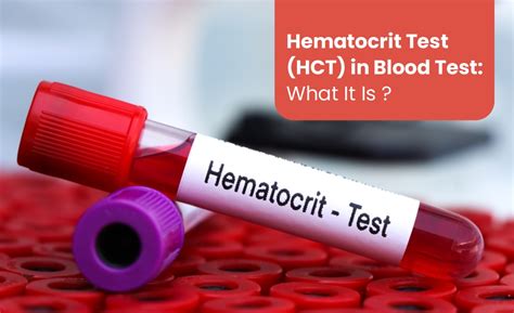 HCT Blood Test