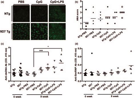 Higher Production Of Antinuclear Antibodies Ana Anti Dsdna