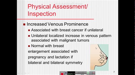 1 Breast Cancer Assessment Of Breast Youtube