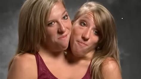 Conjoined Twins Abby And Brittany Hensel Hit Back At Hate After Wedding Revelation