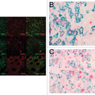 IDO1 Is Expressed In CD163 C TAMs In SPTCL But Not In MF Or LyP Skin