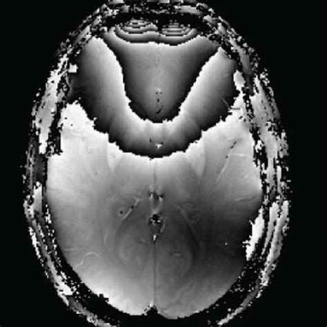 Example Axial Mr Image Slice Depicting Gradient Echo Magnitude A Raw