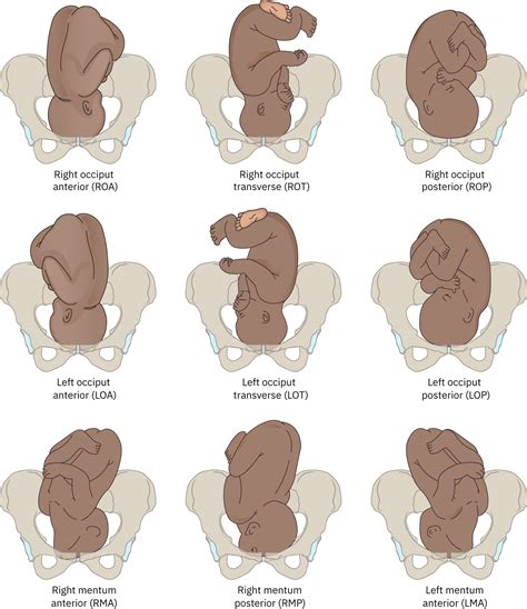 factors influencing  process  labor  birth medicine