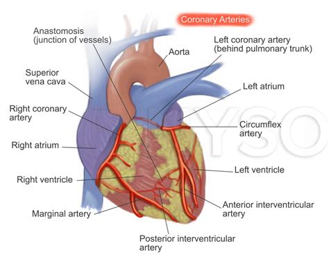 Coronary artery disease - NYSORA