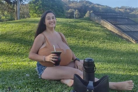 Mulher De Anos Gigantomastia Retira Kg De Mama Em Cirurgia