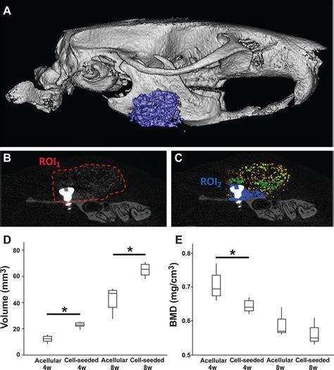 Micro Ct Analysis Demonstrated A Higher Volume Of New Bone Formation