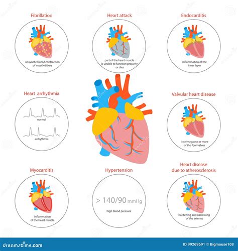 Infographic Heart Disease