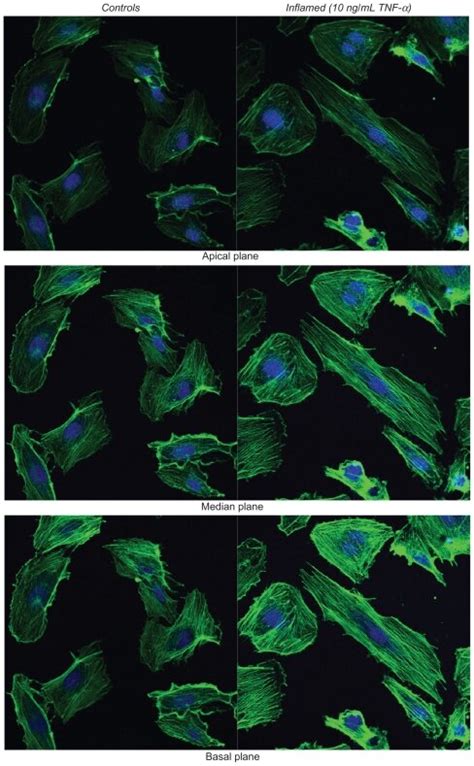 Actin Staining For The Hcaecs Download Scientific Diagram