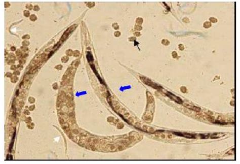 Pdf Molecular Diagnosis Of Strongyloides Stercoralis Infection By Pcr Detection Of Specific