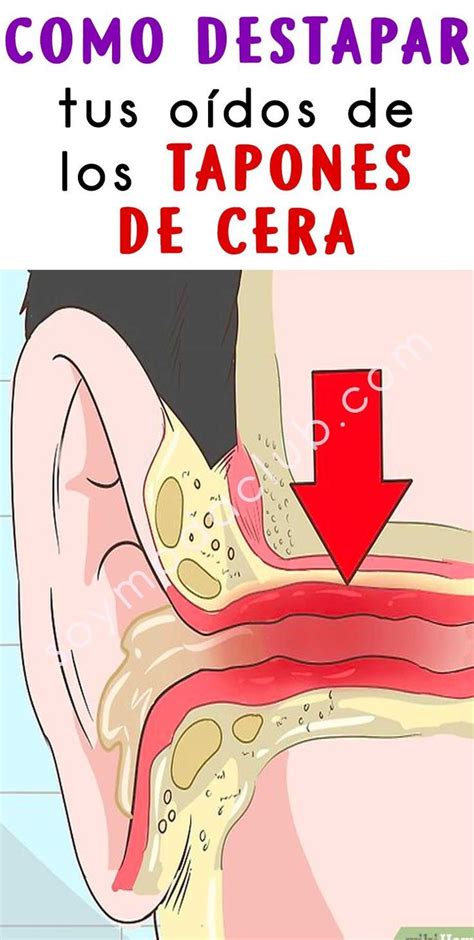 Consejos Simples Para Eliminar La Cera Del O Do Paso A Paso