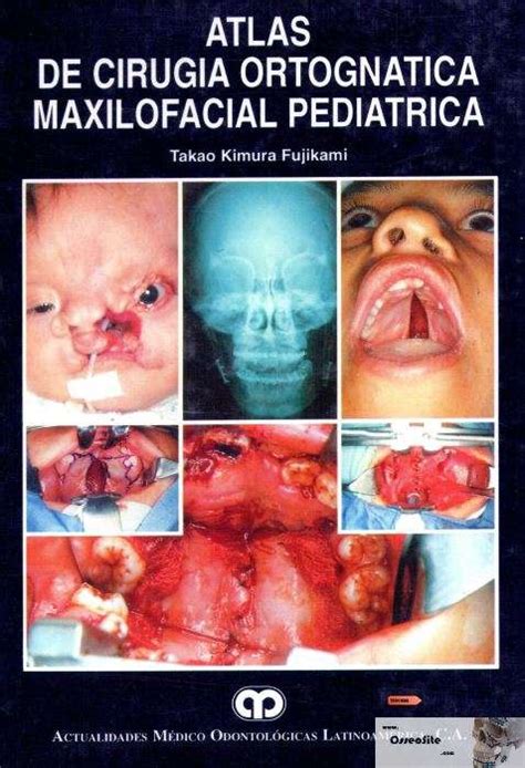 ATLAS DE CIRUGÍA ORTOGNÁTICA MAXILOFACIAL PEDIÁTRICA DE TAKAO KIMURA