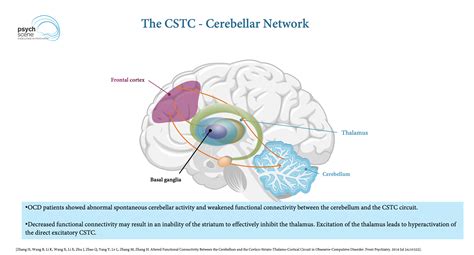 Ocd Brain Serotonin