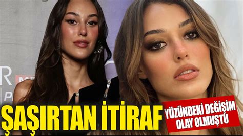 Dilan Çiçek Denizden şaşırtan estetik itirafı