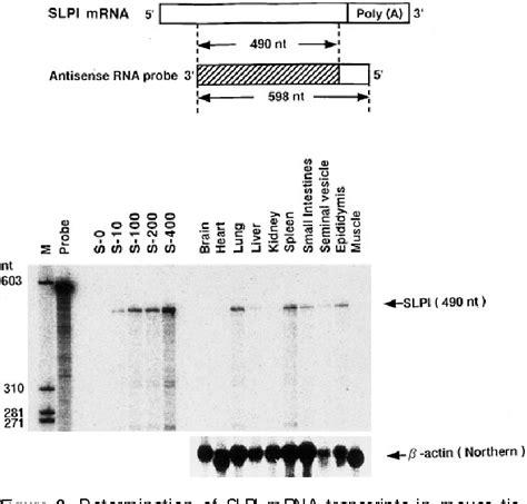 Figure 2 From Bacterial Pneumonia Causes Augmented Expression Of The