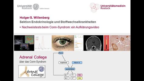 Adrenal College Hormondiagnostik Beim Conn Syndrom Youtube