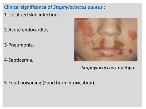 PPT Pyogenic Cocci The Grams Positive Cocci 1 Staphylococci 2