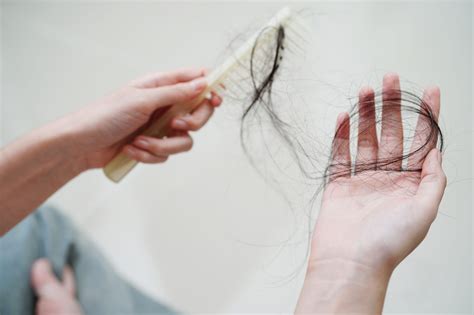 Need to Know About Female Hair Loss Treatment | Bisocor International