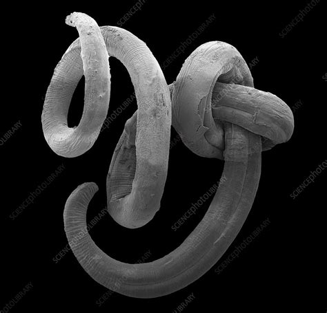 Nematode Electron Microscope