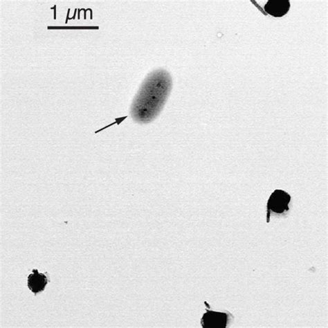 Electron Micrograph Showing A Single Bacterial Cell Arrowed And Four