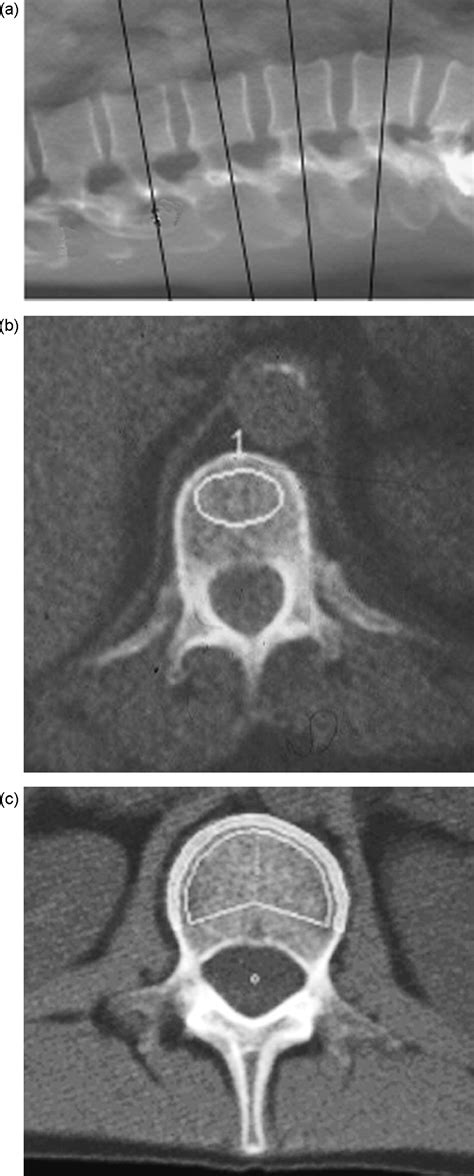 Quantitative Computed Tomography European Journal Of Radiology