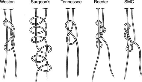 Initial Loop And Knot Security Of Arthroscopic Knots Using High