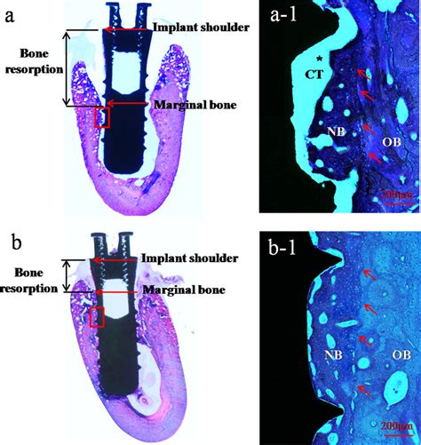 Histological Observations Of Ti Implants A And Ti Cu Implants B At Download Scientific