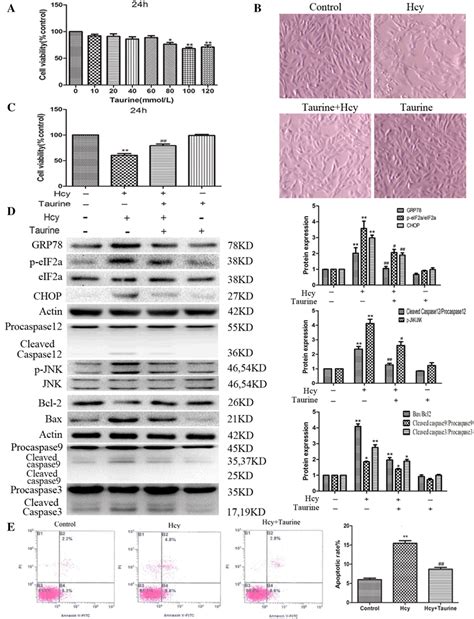 Taurine Attenuated Hcy Induced Apoptosis And The Expression Of