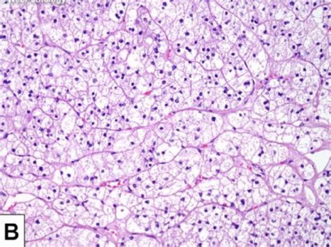 Adrenal Gland Histopathology Flashcards Quizlet