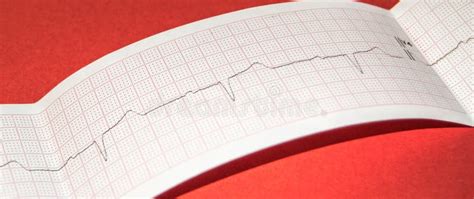 Paper Electrocardiogram On A Red Background Medical Concept Banner