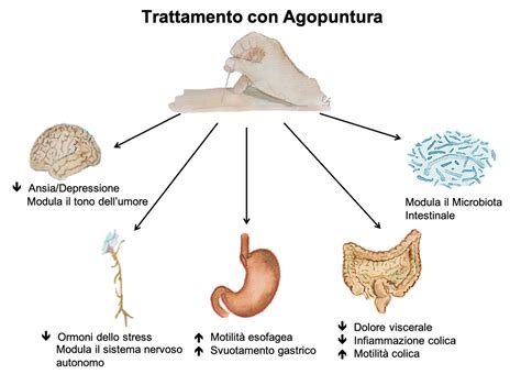 Agopuntura Nel Trattamento Delle Patologie Gastrointestinali Pu