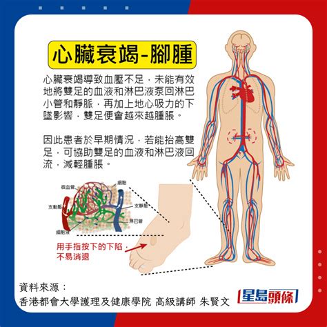 過勞症狀｜女子連續4日特種兵式旅遊 氣喘過勞致心臟衰竭 附自測方法 事事如意生活網站