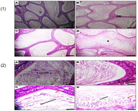 Representative Photomicrographs Of The Epididymis From Control And