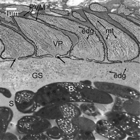 Tem Of S Hirsuta The Sarcocyst Wall Had Rhomboid Shaped Vp That