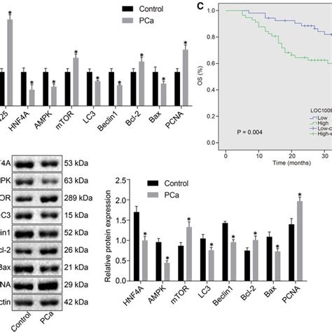 LOC100996425 Is Upregulated In PCa Tissues And Correlated With Lower