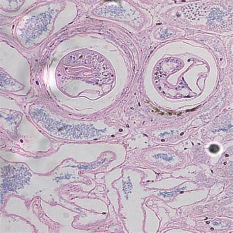 Histological Sections Of O Niloticus Testes Showed Different Stages Of Download Scientific