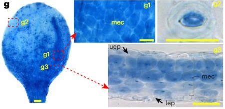 Visualizing Plant Intracellular Inorganic Orthophosphate Distribution