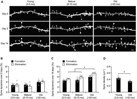 Aging Increases Dendritic Spine Elimination In The Sensory Cortex A