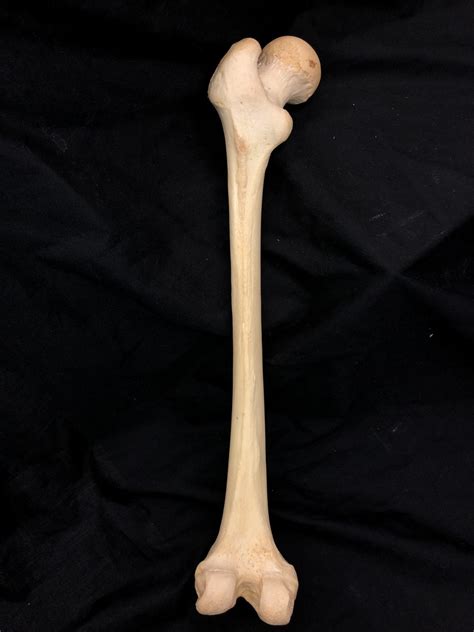 Femur Posterior Diagram Quizlet