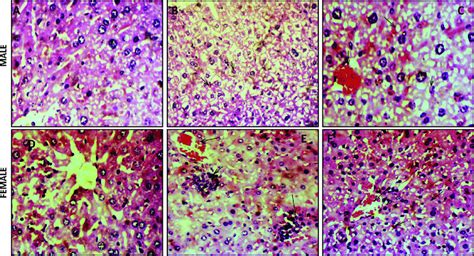 Photomicrographs Of Histopathological Changes In The Liver Section