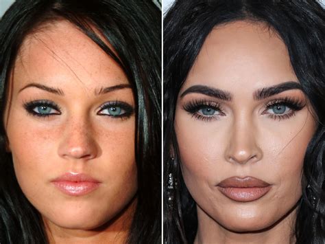 Megan Fox Nose Job Before After