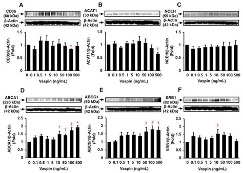 Ijms Free Full Text Anti Atherogenic Effects Of Vaspin On Human